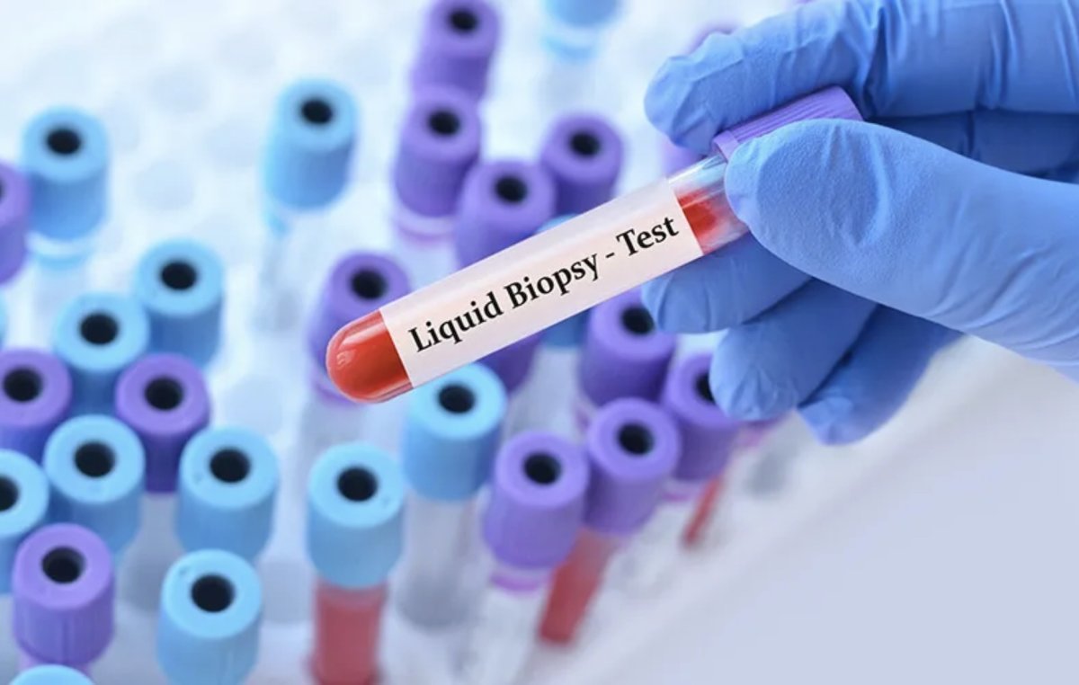 Biomarkeri sanguini: O nouă eră în predicția bolilor